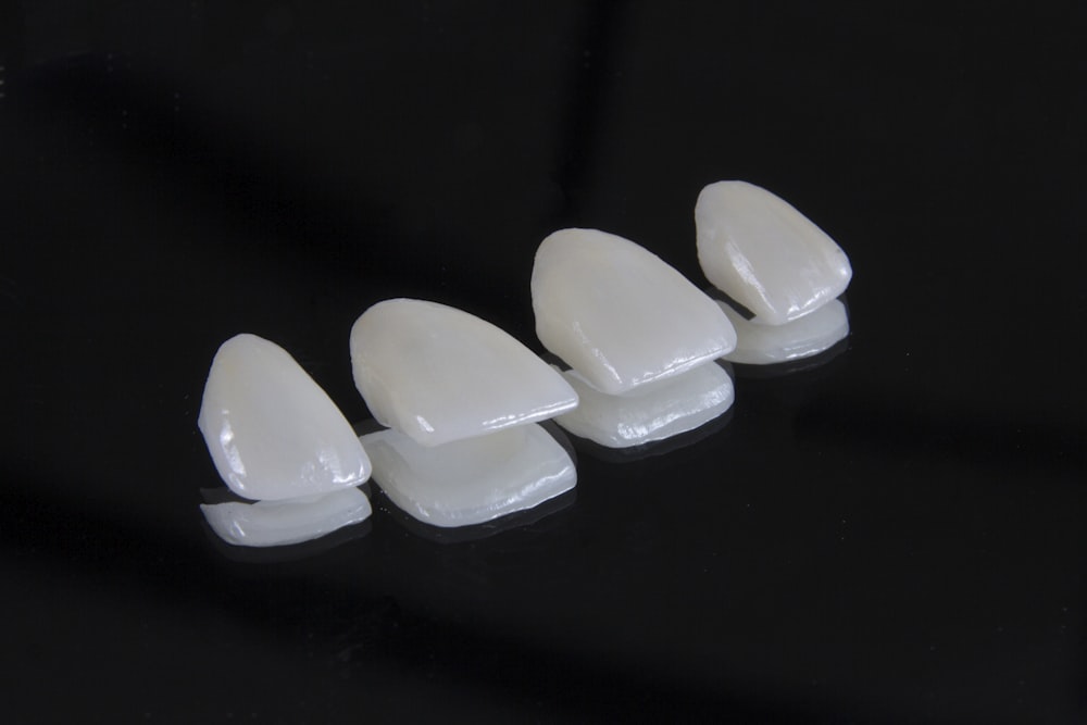 Finished ceramic veneers before bonding (example image)